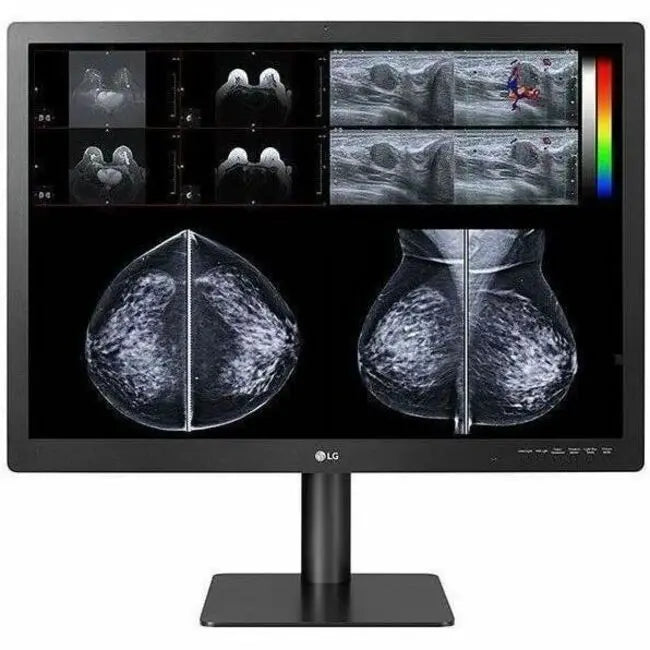 LG Electronics 31HN713D-B 31-Inch 12MP IPS Medical Diagnostic Monitor with Pathology and Focus View Modes