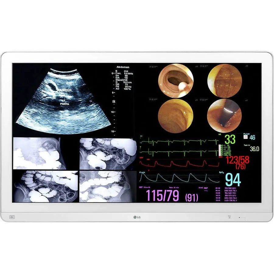 LG Electronics 32HL714S-W 31.5-inch 4K IPS Surgical Monitor with HDR10, 12G-SDI, and Multi-View Support