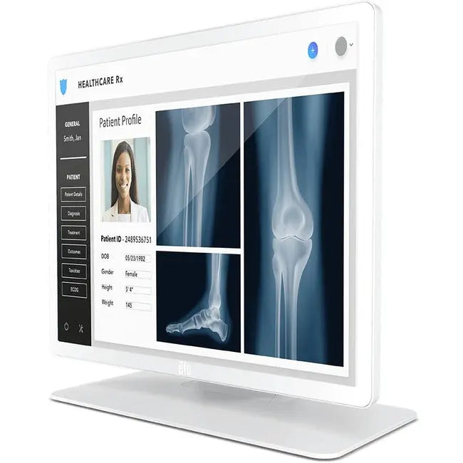 Elo 1903LM 19-Inch Medical Grade Touchscreen Monitor with DICOM 14 Compliance and VESA Mount Compatibility