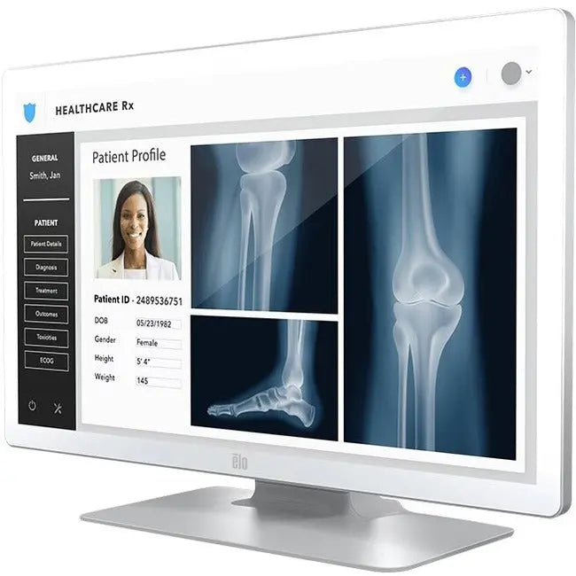 Elo 2703LM 27-Inch Medical Grade Touchscreen Monitor with DICOM Compliance and VESA Mount