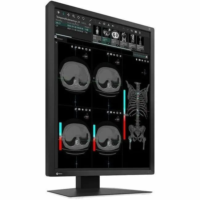 EIZO RadiForce MX217-BK 21.3-inch Widescreen LED Monitor for Medical Imaging